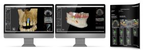 3-Dimentional Digital Dental Technology