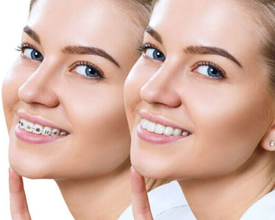 Orthodontics Dental Treatment Lonson