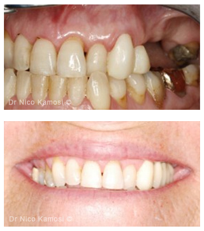 Case Studies Dental Implants