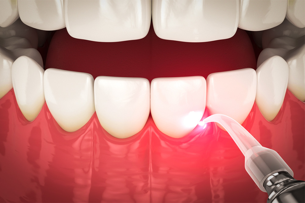 Diagnosis And Treatments for Gum Disease