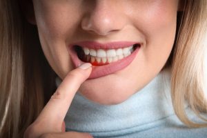 Gum Diseases London Specialist Dentists