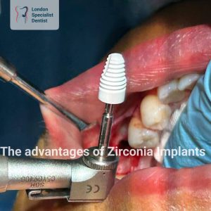 Titanium vs Zirconia cover