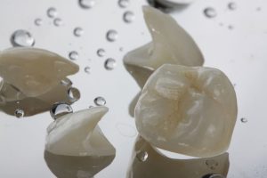 Dental-Crowns