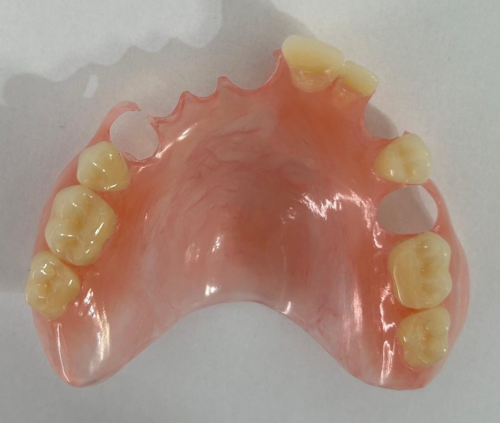 BPA-free Flexible Dentures