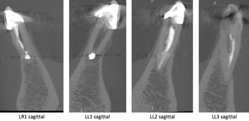 Image Cone Beam CT