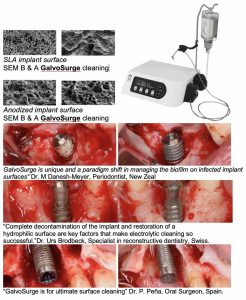 Peri-implantitis diagnosis and treatments